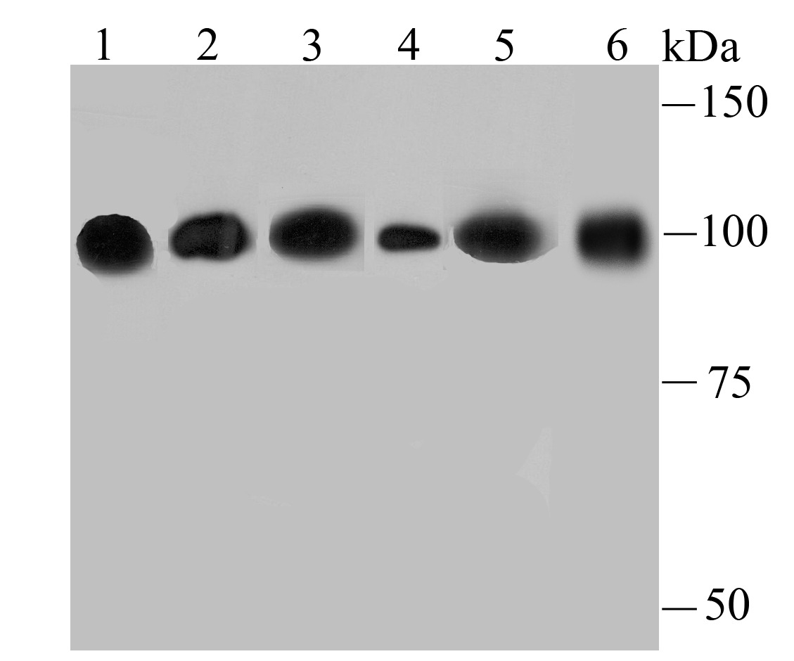 Anti-alpha Actinin 4 Antibody (7D211)