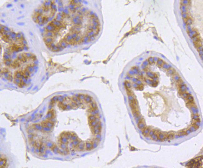 Anti-alpha 1 Catenin Antibody (9R277)