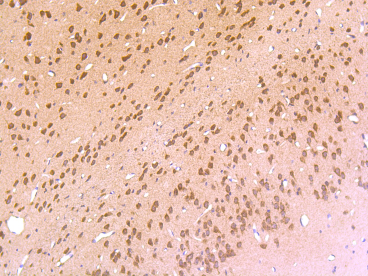 Anti-HTR2C Antibody (5H488)
