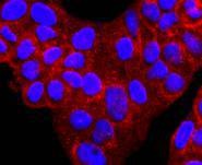 Anti-Serpin A1 Antibody (8W352)