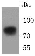 Anti-5T4/TPBG Antibody (2E446)