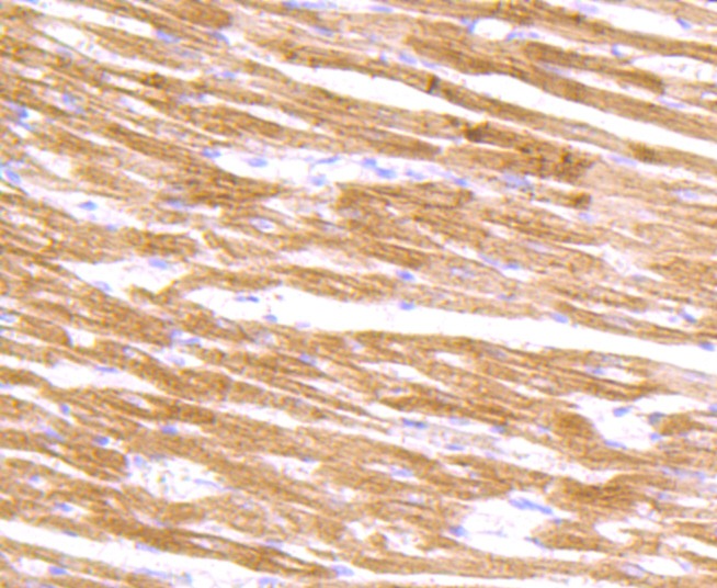 Anti-Alpha Actinin 2 Antibody (2O342)
