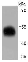Anti-Serpin A1 Antibody (8W352)