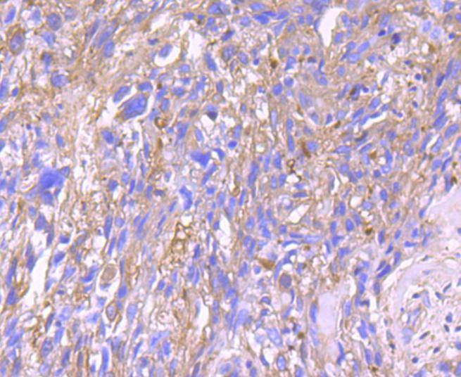 Anti-Serpin A1 Antibody (8W352)