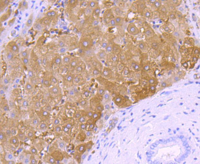 Anti-FTCD Antibody (8U835)
