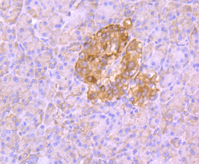Anti-ALDOA Antibody (1Q763)
