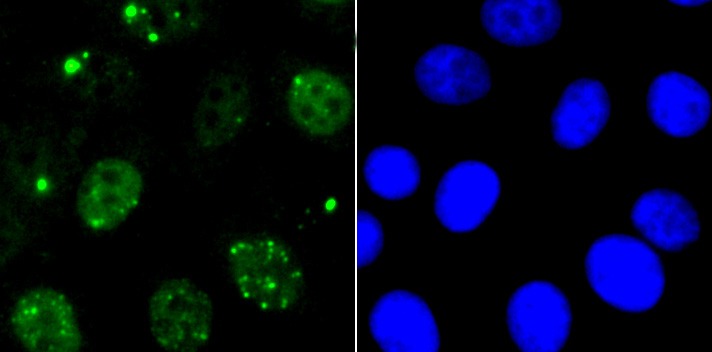 Anti-53BP1 Antibody (3K586)