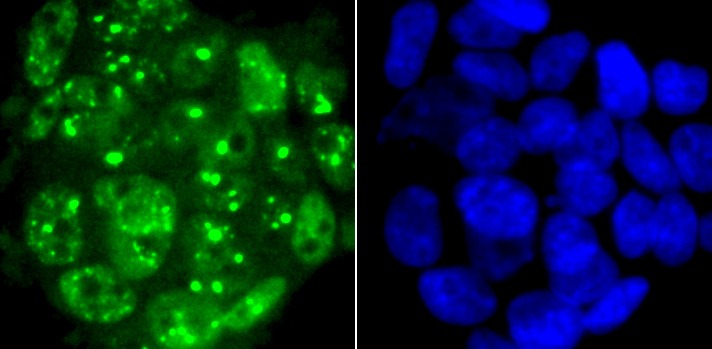 Anti-53BP1 Antibody (3K586)