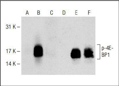 Anti-Phospho-4EBP1/2/3 (Thr45) Antibody (2T82)