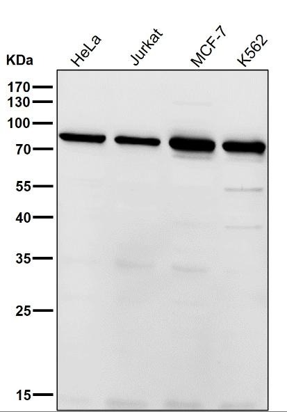 Anti-Alkaline Phosphatase/ALPL Antibody (3F463)