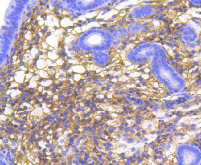 Anti-alpha 1 Catenin Antibody (9R277)