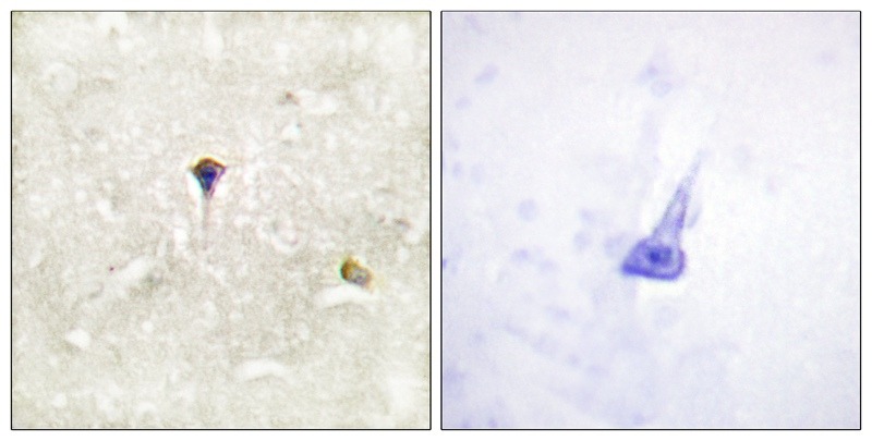 Anti-Phospho-ALK (Tyr1604) Polyclonal Antibody
