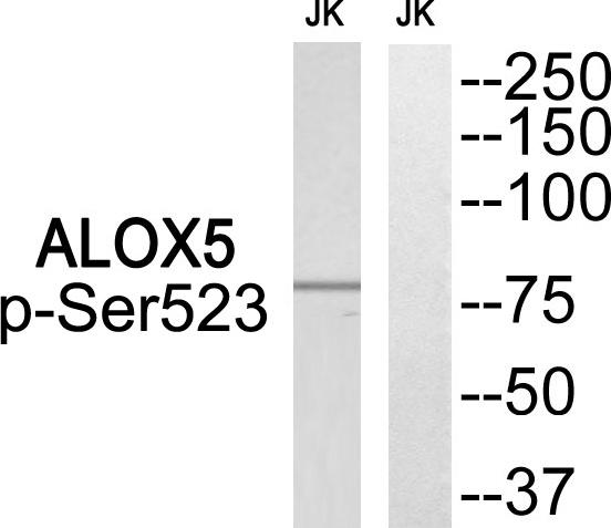 Anti-Phospho-ALOX5 (Ser523) Polyclonal Antibody 2