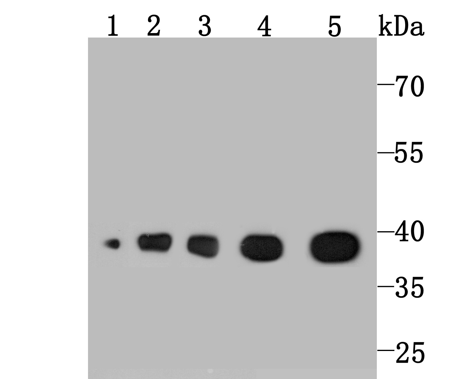 Anti-ALDOA Antibody (1Q763)