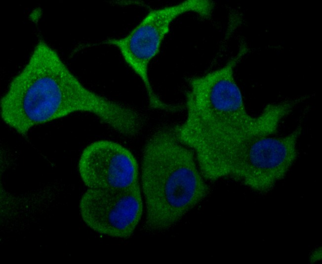 Anti-ALDOA Antibody (1Q763)