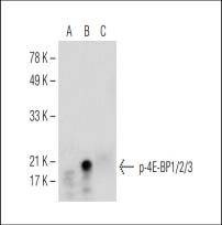 Anti-Phospho-4EBP1/2/3 (Thr45) Antibody (2T82)