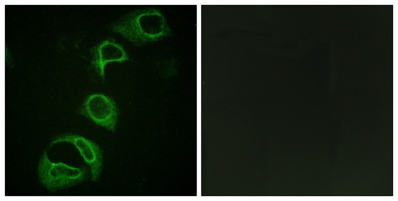 Anti-Phospho-ALK (Tyr1604) Polyclonal Antibody