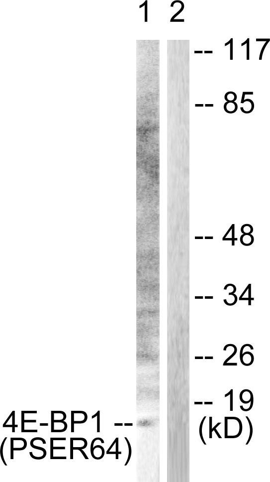 Anti-Phospho-4EBP1 (Ser65) Polyclonal Antibody