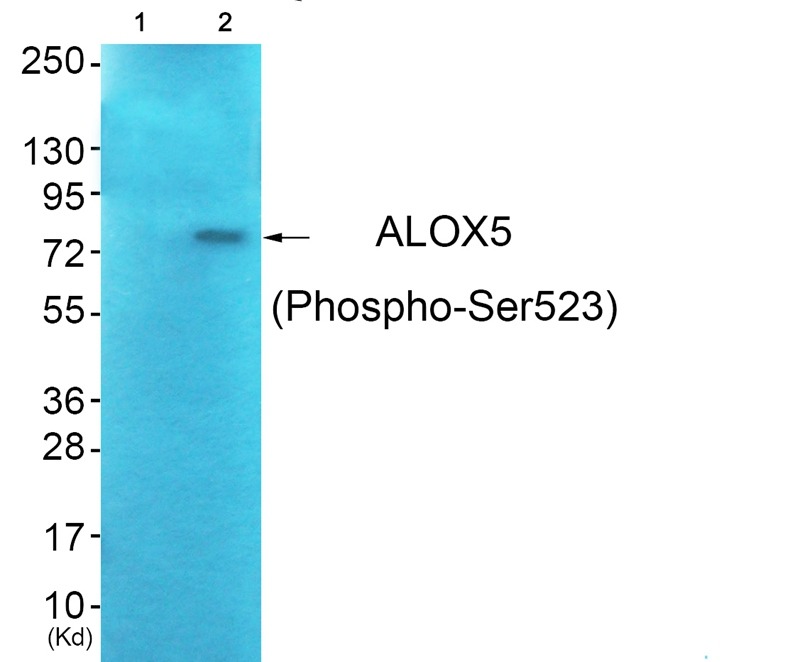 Anti-Phospho-ALOX5 (Ser523) Polyclonal Antibody 2