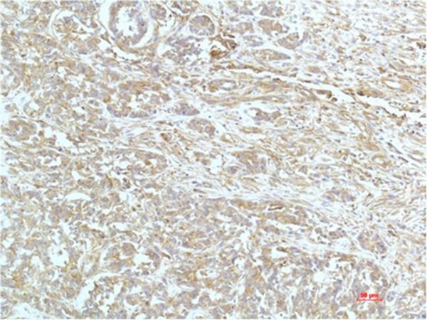 Anti-ACTA1 Antibody (8J575)