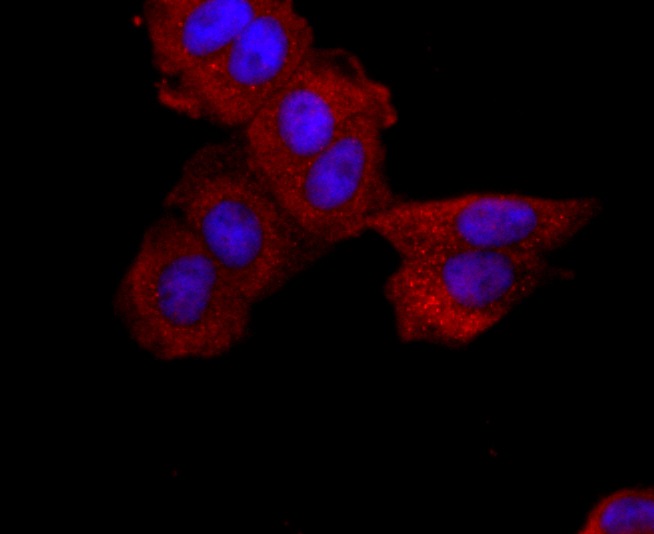 Anti-ABCG2 Antibody (4D379)