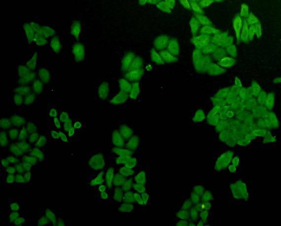 Anti-AKR7A2 Antibody (7I916)