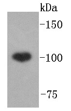 Anti-ABCF1 Antibody (8X278)
