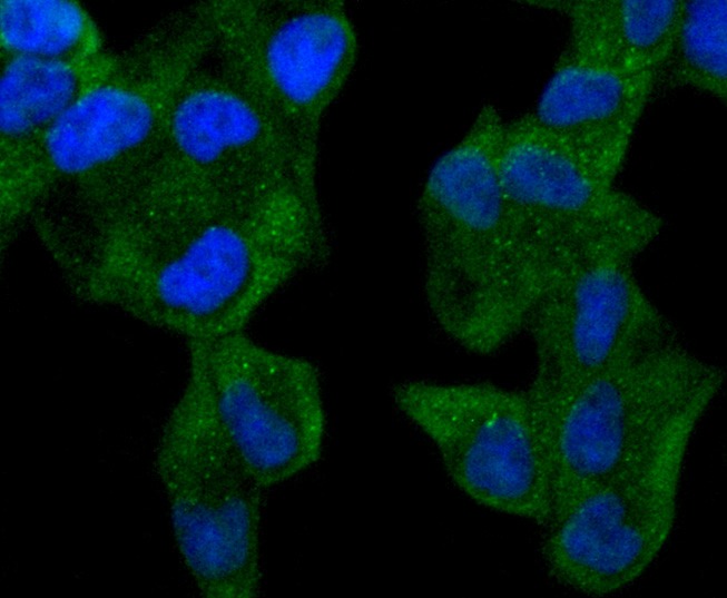 Anti-ABCF1 Antibody (8X278)