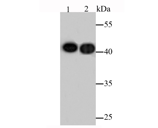Anti-ACTA1 Antibody (9M191)