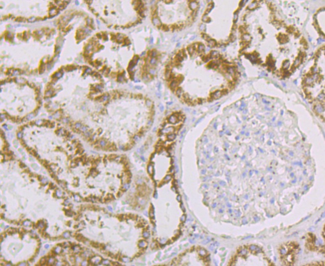 Anti-Aconitase 2 Antibody (9R777)