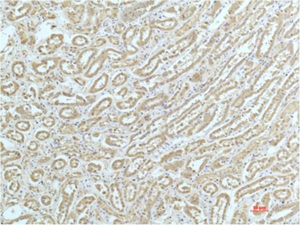 Anti-ACTA1 Antibody (8J575)