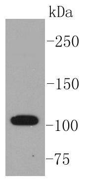 Anti-ABCG1 Antibody (6T884)