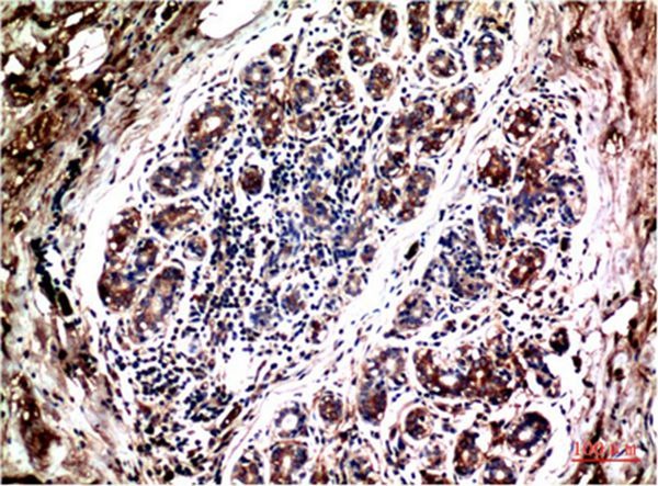 Anti-AKT1 Antibody (9U632)