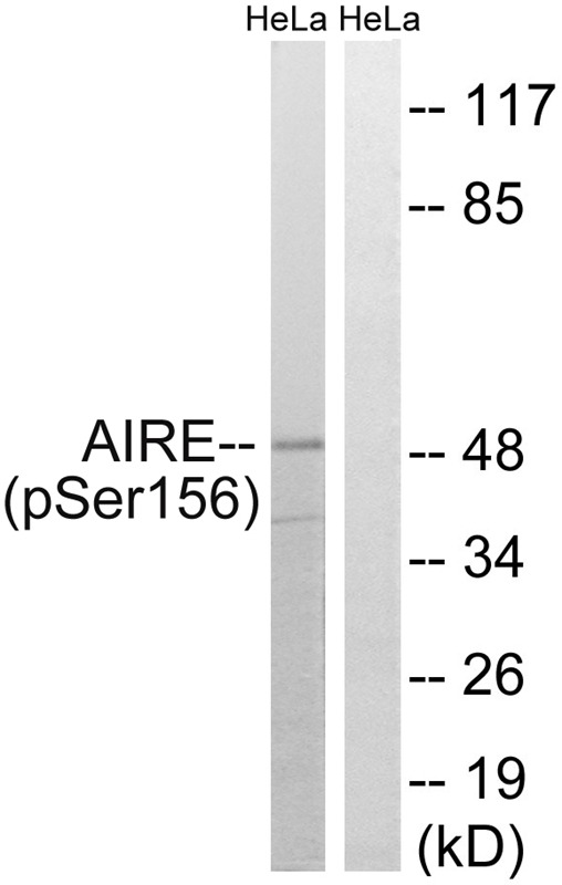 Anti-Phospho-AIRE (Ser156) Polyclonal Antibody