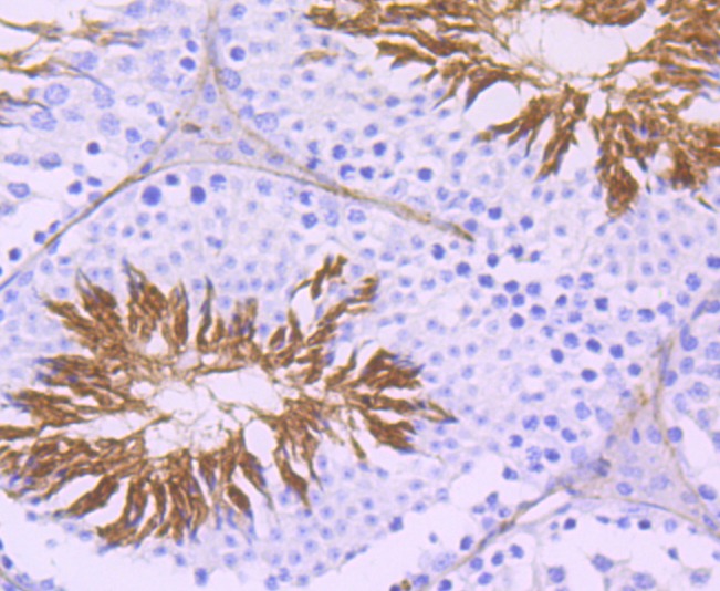 Anti-ACE Antibody (1S991)