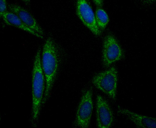 Anti-Aconitase 2 Antibody (9R777)