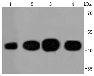 Anti-ACTA1 Antibody (9M191)