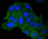 Anti-AKAP14 Antibody (9H736)