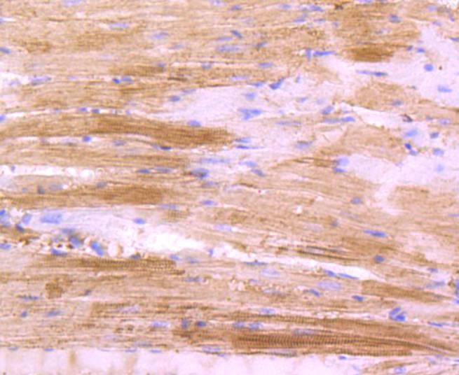 Anti-ACTA1 Antibody (8R189)