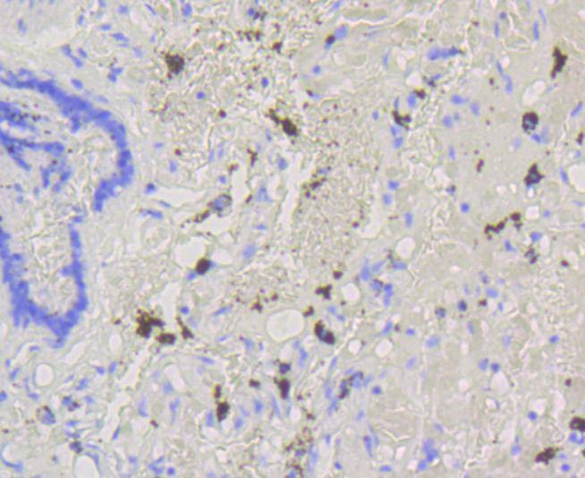 Anti-ABCG1 Antibody (6T884)