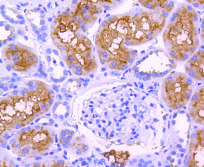 Anti-ABCF1 Antibody (8X278)