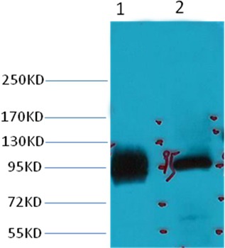 Anti-ABCB5 Antibody (3W593)