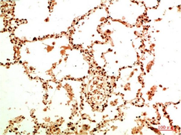 Anti-Acetyl-NF-kB p65 (Lys314/315) Antibody (9T471)