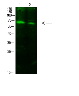 Anti-Acetyl-ACSS1 (Lys642) Polyclonal Antibody