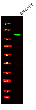 Anti-Phospho-ACK1 (Tyr857, 858) Polyclonal Antibody