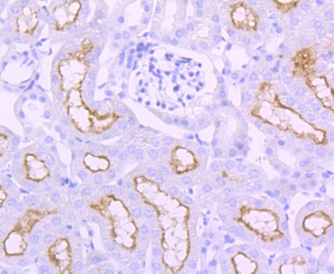 Anti-ACE Antibody (1S991)