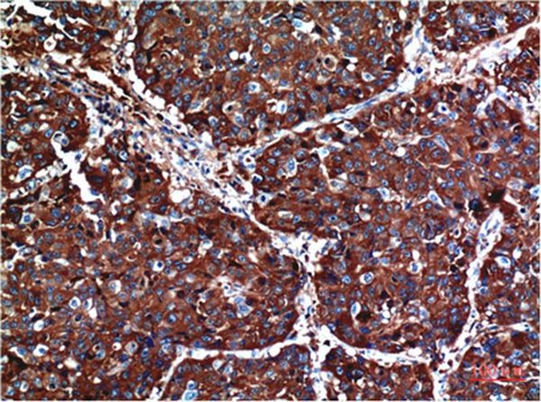 Anti-AKT1 Antibody (9R109)