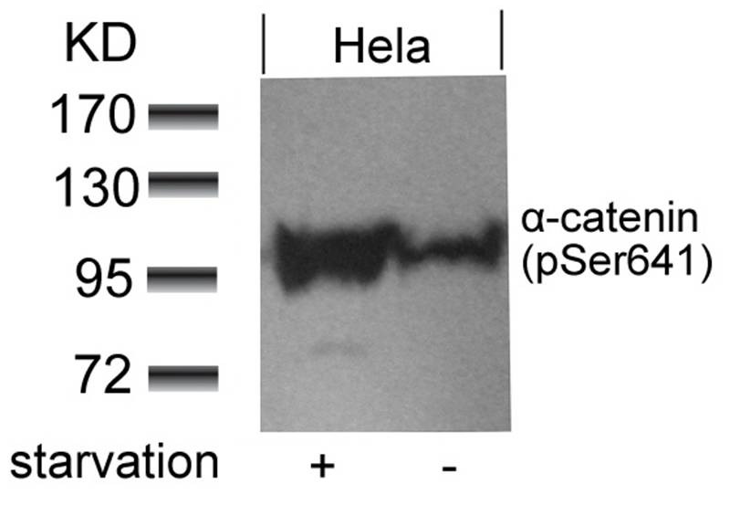 Anti-Phospho-a-catenin (Ser641) Polyclonal Antibody