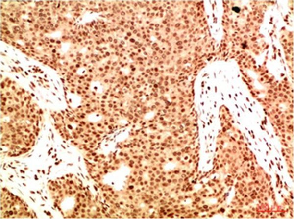 Anti-Acetyl-NF-kB p65 (Lys314/315) Antibody (9T471)