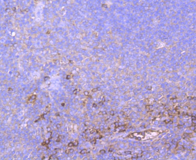 Anti-Alpha-2-macroglobulin Antibody (9L785)